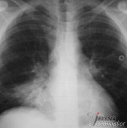 (Bildquelle: www.radiology.med.miami.edu)
