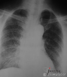 (Bildquelle: www.radiology.med.miami.edu)