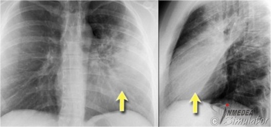 (www.radiologyassisstant.nl)