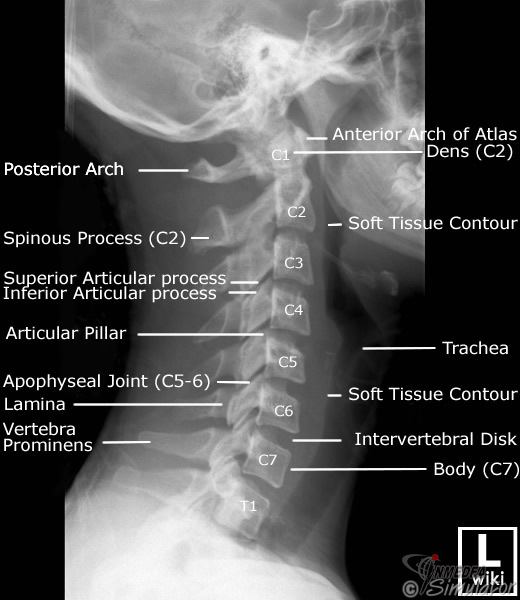 (Bildquelle: www.wikiradiography.net)