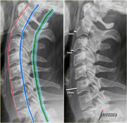 (Bildquelle: www.radiologyassistant.nl)