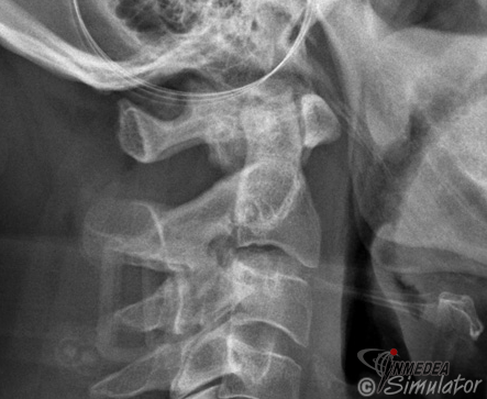 (Bildquelle: www.radiologymasterclass.co.uk)