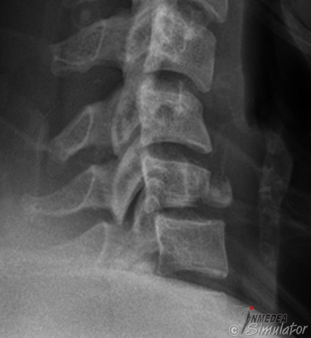 (Bildquelle: www.radiologymasterclass.co.uk)