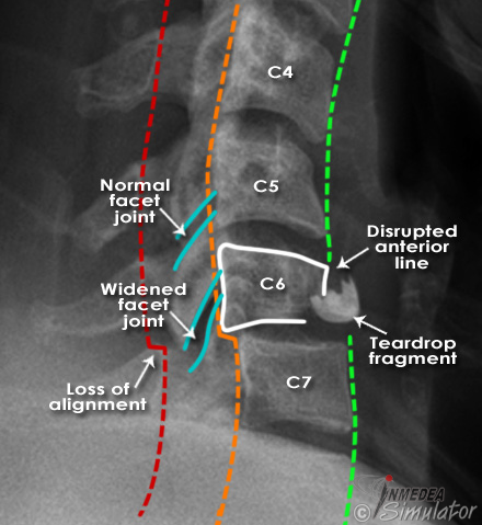 (Bildquelle: www.radiologymasterclass.co.uk)