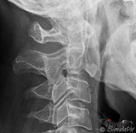 (Bildquelle: www.radiologymasterclass.co.uk)