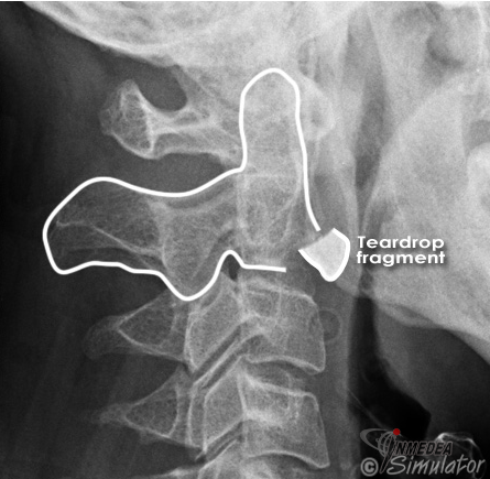 (Bildquelle: www.radiologymasterclass.co.uk)